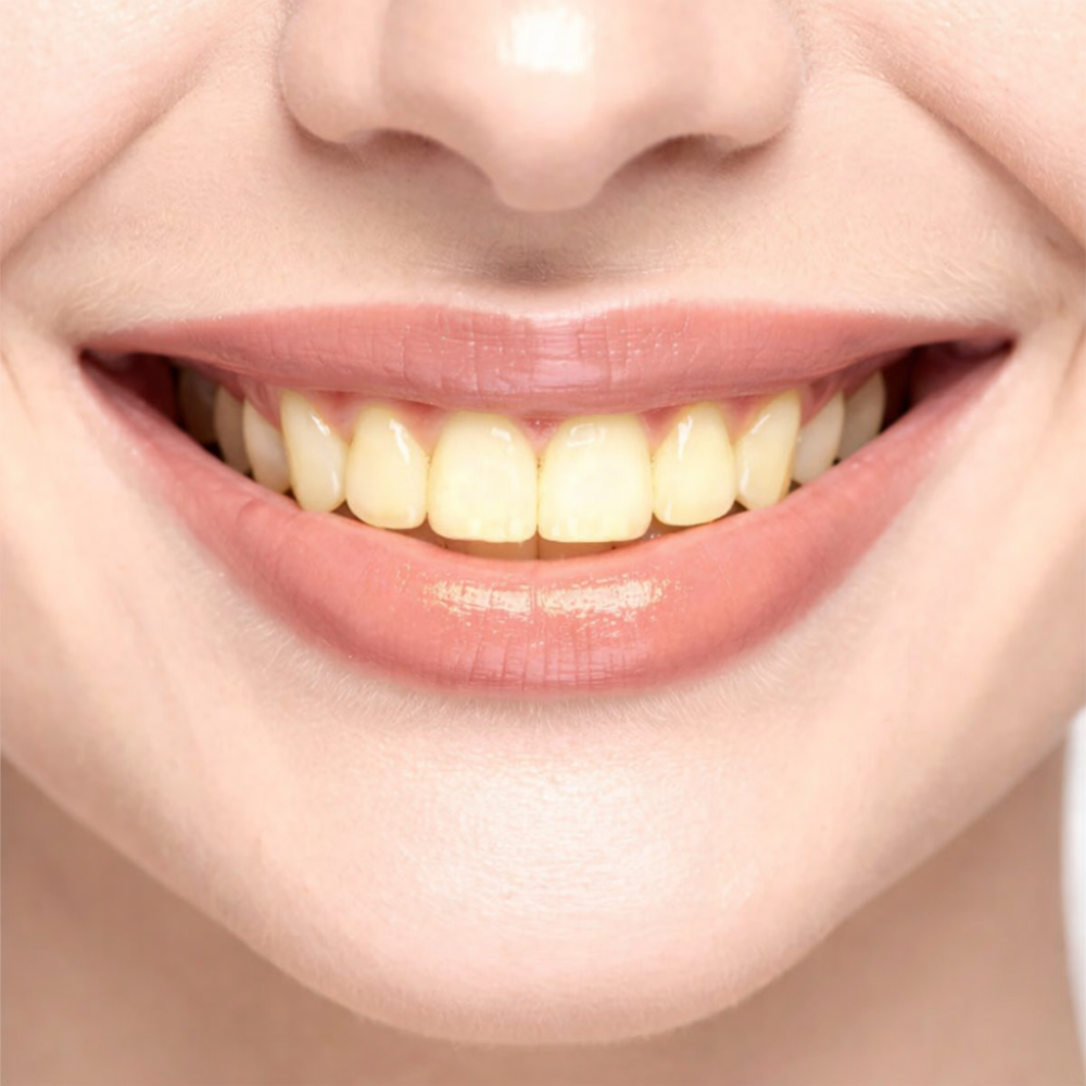 Close-up of a person's mouth with a focus on teeth.
