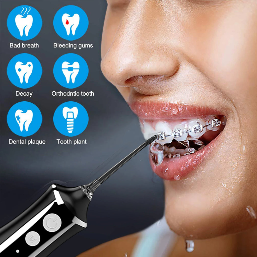 Fairywill Water Flosser – USB, 5 Tips, Travel