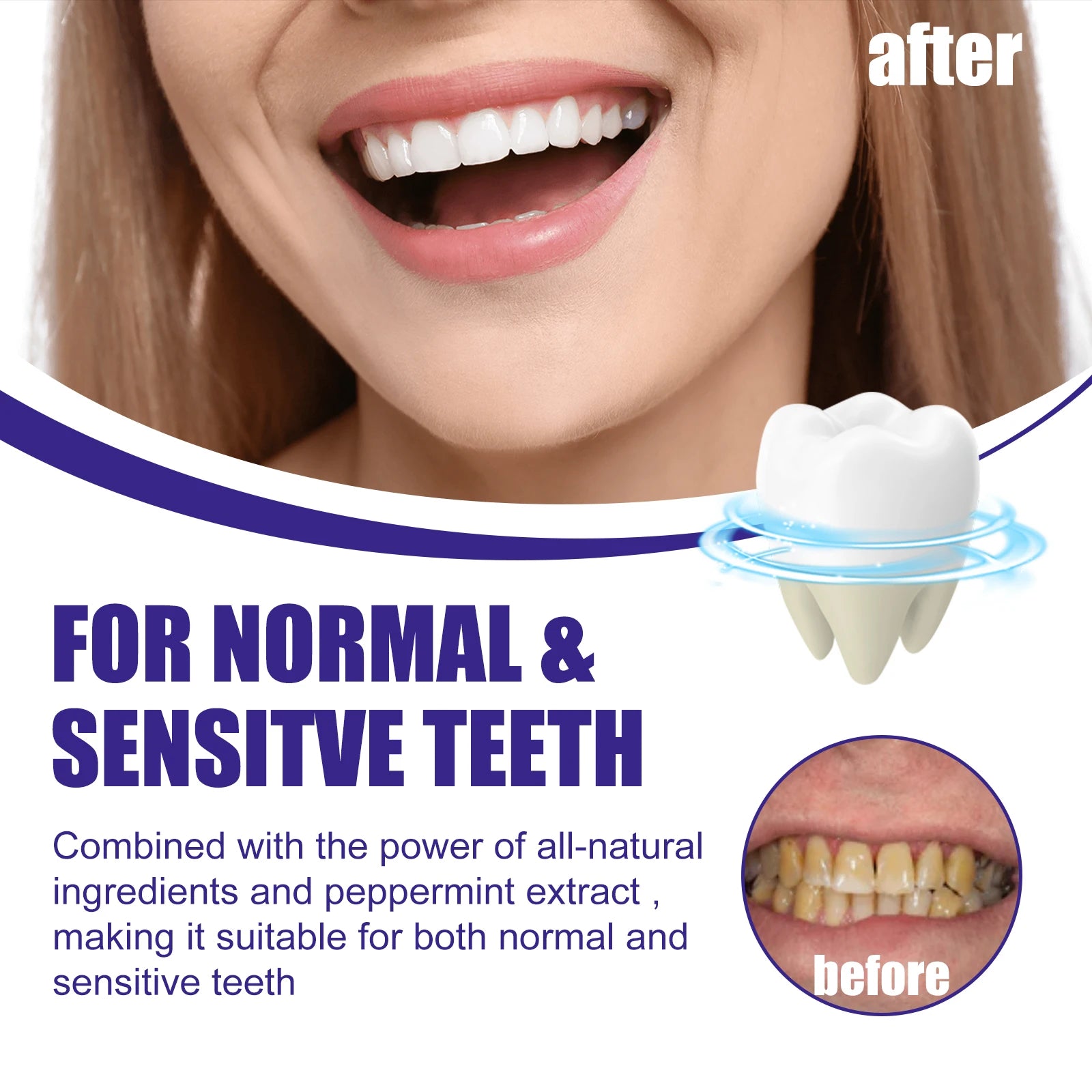 Advertisement for dental product showing a before and after comparison of teeth.
