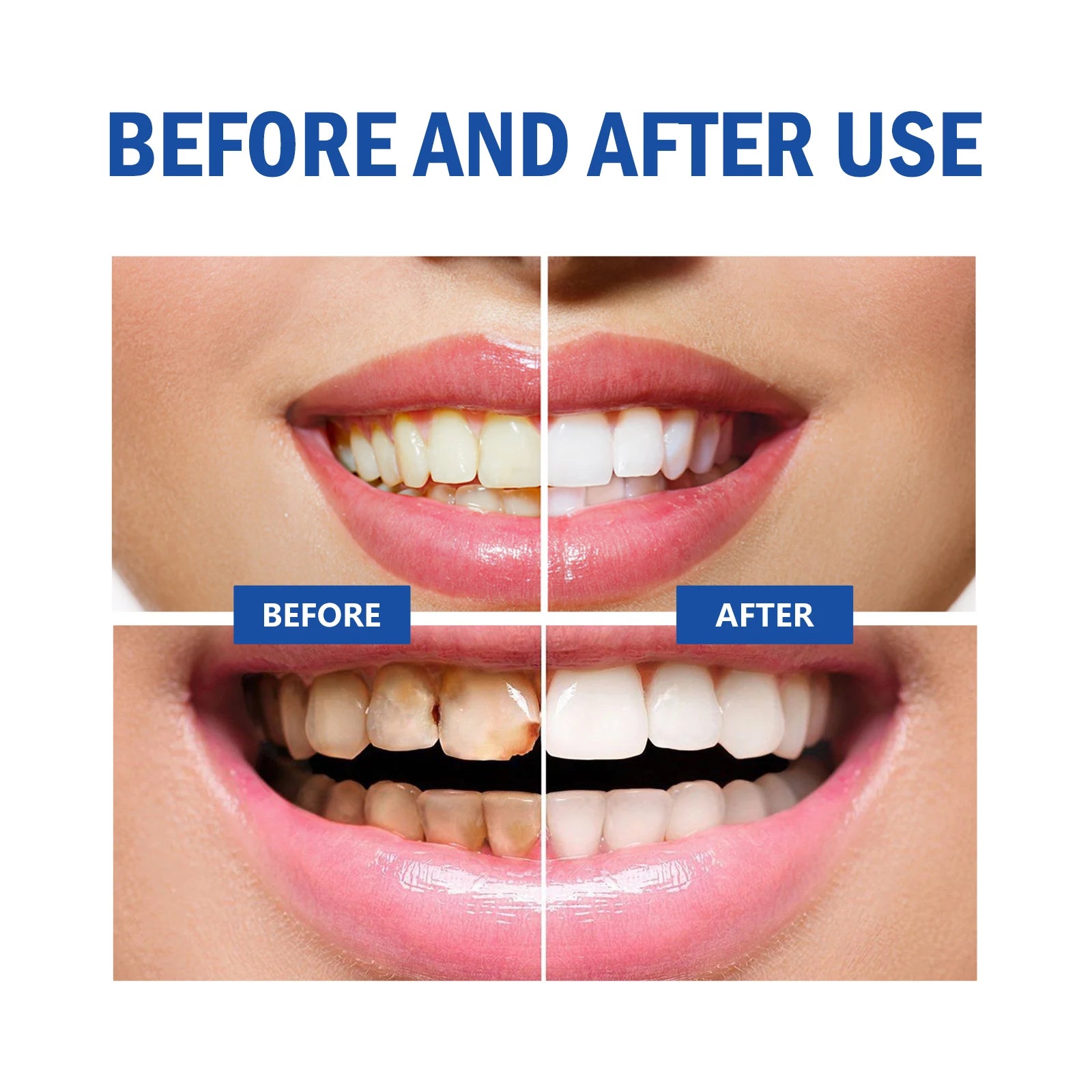 Before and after use comparison of teeth whitening with a blue 'BEFORE AND AFTER USE' label.